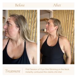 Avella Beauty - Single Cryo One Slimming Session