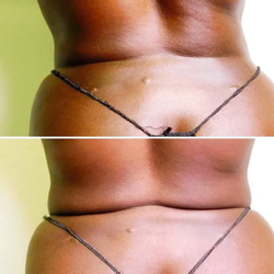 Flawless Body Studio - Flawless Body Studio