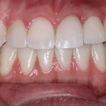 Pawley Orthodontics - 3.21.15 - Orthodontists Near Me - Glendora, California