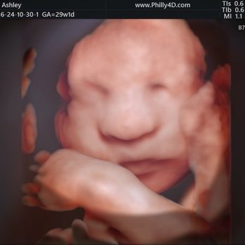 Fetal Vision Imaging - This is our babygirl beautifully captured - Diagnostic Imaging Near Me - Philadelphia, Pennsylvania Fetal Vision Imaging - This is our babygirl beautifully captured - Diagnostic Imaging Near Me - Philadelphia, Pennsylvania