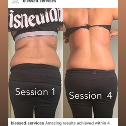 Blessed Body Spa - Wood Therapy/Cavitation