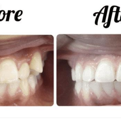 My Orthodontist - Cherry Hill