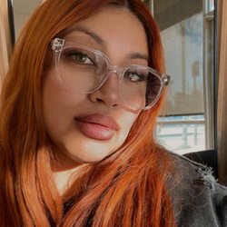 NAKEDMD - Rancho Cucamonga - Loving My Lips Thanks Ann
