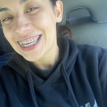 Gabucan Family Dentistry - After my orthodontist appointment - Orthodontists Near Me - Milpitas, California Gabucan Family Dentistry - After my orthodontist appointment - Orthodontists Near Me - Milpitas, California