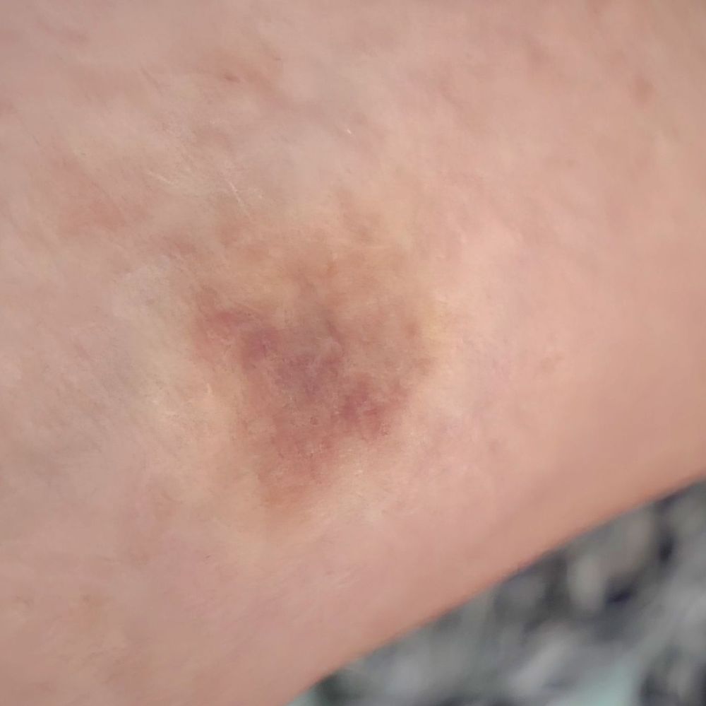 Old West End Community Health Center - grief counselor in Toledo, OH