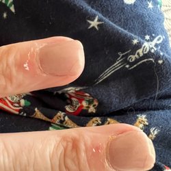 Natural Nails & Spa - Chipped nail on my left hand and look at the skin around my nails.
