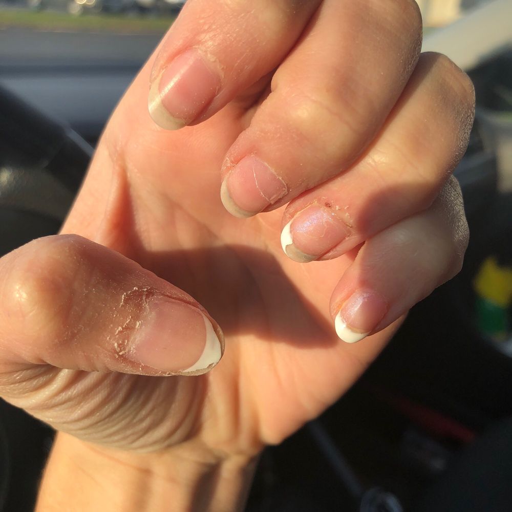 Ring finger cuticle damaged.  2 nails completely removed, two damaged, and one intact.  2 days after service received!