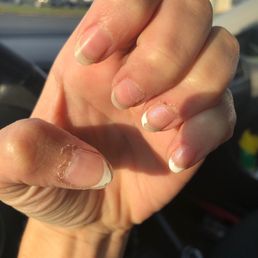 Ring finger cuticle damaged.  2 nails completely removed, two damaged, and one intact.  2 days after service received!