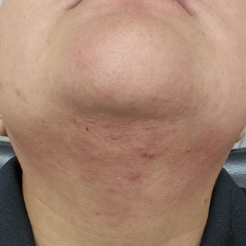 Brow Arc - Montebello - Before and after. Eyebrow, upper lip and neck threading. No tools!!! - Hair Salons Near Me - Montebello, California Brow Arc - Montebello - Before and after. Eyebrow, upper lip and neck threading. No tools!!! - Hair Salons Near Me - Montebello, California