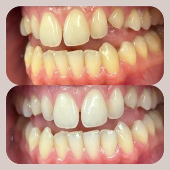 Avila Dental - General Dentistry Near Me - Chicago, Illinois Avila Dental - General Dentistry Near Me - Chicago, Illinois