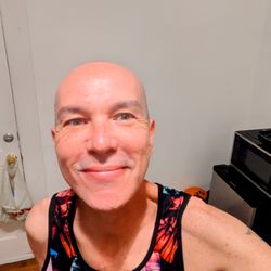 Mt. Tam Laser and Skin Care - June 2025 after treatment