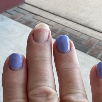 Top Nails - Chipped gel polish after 4 days. - Waxing Near Me - Venice, Florida Top Nails - Chipped gel polish after 4 days. - Waxing Near Me - Venice, Florida