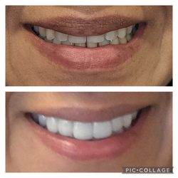 Orest Frangopol, DDS - Before and After