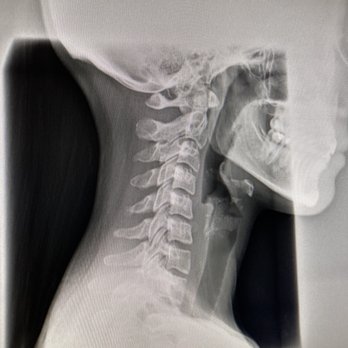 Rhodes Chiropractic - This is a picture of my X-ray performed by Dr. Rhodes. The exam room is big and open. - Chiropractors Near Me - Tigard, Oregon Rhodes Chiropractic - This is a picture of my X-ray performed by Dr. Rhodes. The exam room is big and open. - Chiropractors Near Me - Tigard, Oregon