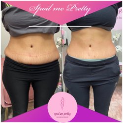 Spoil Me Pretty Aesthetics - Before and After
