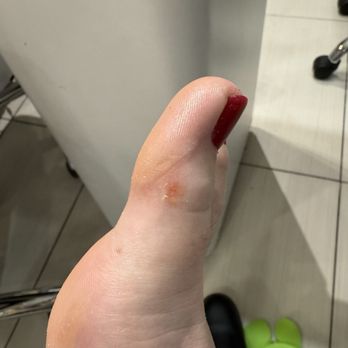 Midtown Nail Spa - Right big toe - small nick from "cheese grater" foot file - Nail Salons Near Me - Raleigh, North Carolina