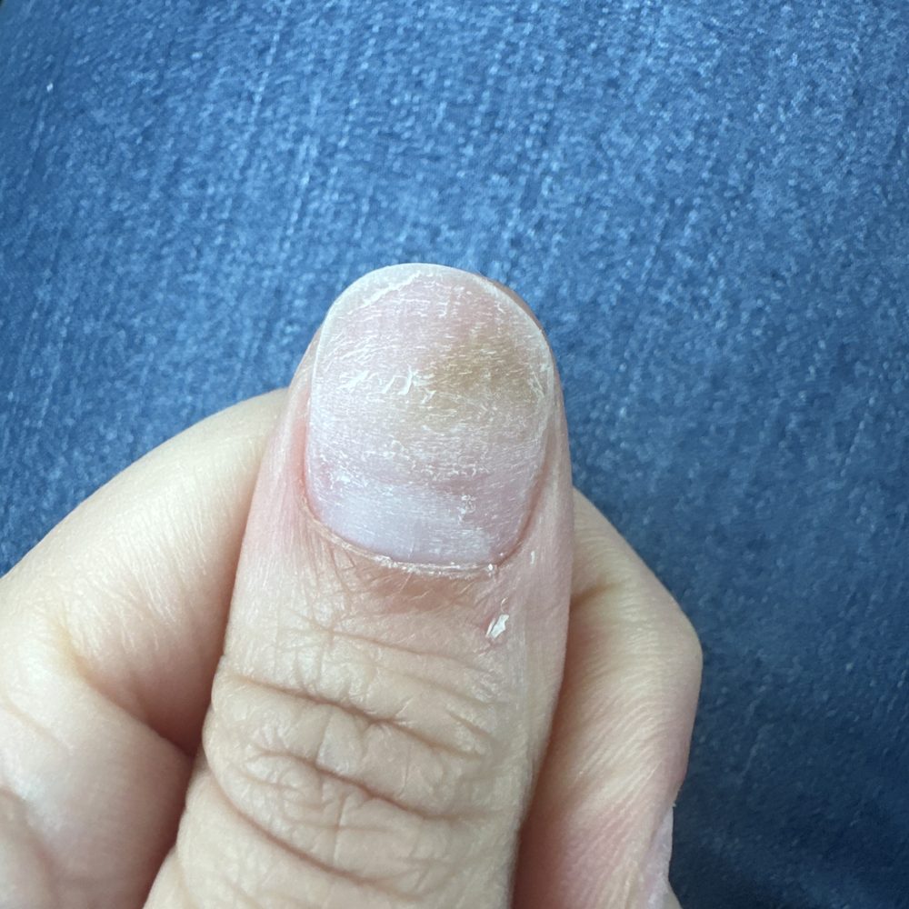 Nail Nail