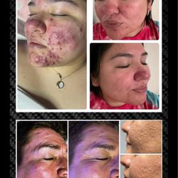 The Beauty Spot Advance Esthetics &Training Institute - It's been 3 years that I have joined forces with Evolve Tx Medical Group