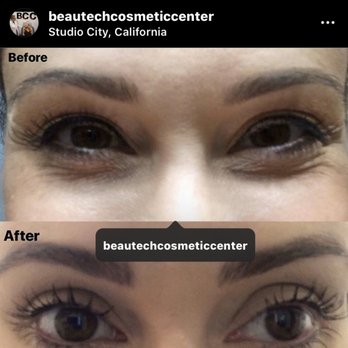 Nu Med Spa - Encino - Up To 37% Off - Los Angeles, CA Groupon