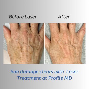 Profile MD - Medical Spas Near Me - Severna Park, Maryland Profile MD - Medical Spas Near Me - Severna Park, Maryland