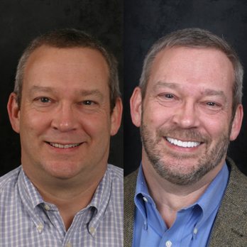 Advanced Dentistry at Windhaven - Oral Surgeons Near Me - Plano, Texas