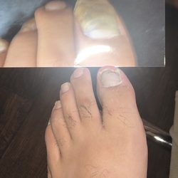 Kourosh Harounian, DPM - Laser nail