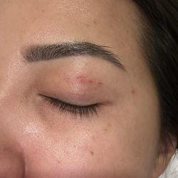 Threading By Preet - Scabs from their treading