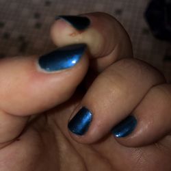 Love & Care Nails - Cut finger :(