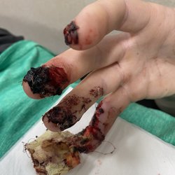 Aviram Moshe Giladi, MD - 1 week