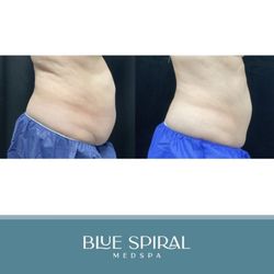 Blue Spiral Medical Spa