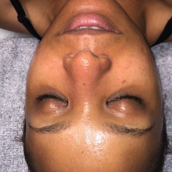 Bella Viso Spa and Wellness - Hydrated skin! - Skin Care Near Me - Raleigh, North Carolina Bella Viso Spa and Wellness - Hydrated skin! - Skin Care Near Me - Raleigh, North Carolina