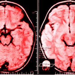 Science Explains What Happens To Someone’s Brain From Complaining Too Much Read more: https://bit.ly/2ogN1fZ