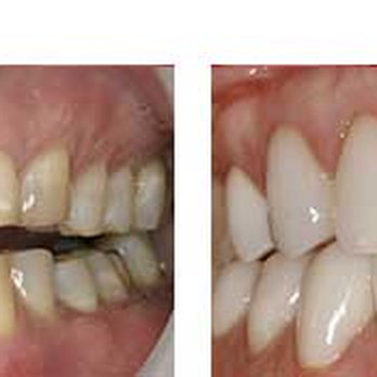 Everson Dental Clinic - General Dentistry Near Me - Everson, Washington