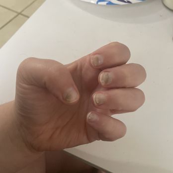 Kai’s Nail Spa - Fungus - Nail Salons Near Me - Davie, Florida