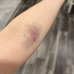 very Painful