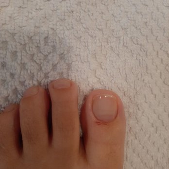 Lux Nail Bar - Shows the cuticle snippers cut me. - Nail Salons Near Me - Mesquite, Texas Lux Nail Bar - Shows the cuticle snippers cut me. - Nail Salons Near Me - Mesquite, Texas
