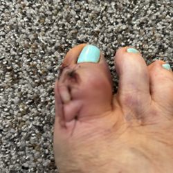 The CORE Institute - North Phoenix - Operated toe