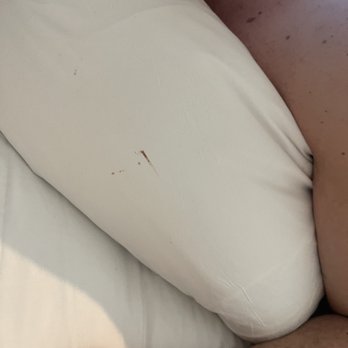Pendry Park City - Blood stains on the other side of bf pillow? Gross - Resorts Near Me - Park City, Utah Pendry Park City - Blood stains on the other side of bf pillow? Gross - Resorts Near Me - Park City, Utah