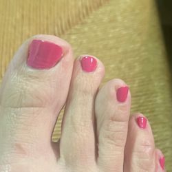 Ruby Nails - My big toe nail naturally has an angled edge- the nail was cut way back below the natural edge, but this was painful & looks strange.