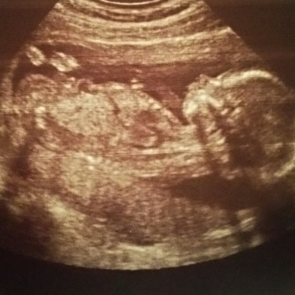 Baby Views - Ultrasound Imaging Centers Near Me - Little Rock, Arkansas Baby Views - Ultrasound Imaging Centers Near Me - Little Rock, Arkansas