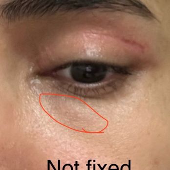 Chicago Oculofacial Plastic Surgery - Ophthalmologists Near Me - Chicago, Illinois
