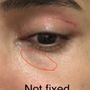 Chicago Oculofacial Plastic Surgery
