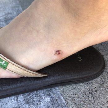Nail Pro - I just wanted callous removal services... instead they removed my skin. - Nail Salons Near Me - Monterey Park, California