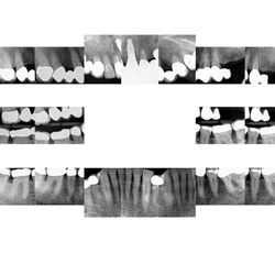 Coast Dental - Before Choi