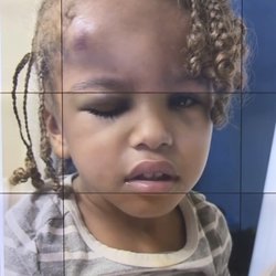 McGill Avenue Child Development Center - Large knot on baby boys head! They refuse to give answers!