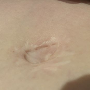 CosMed - Cosmetic Surgeons Near Me - Tijuana, BCN