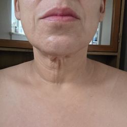 Houston Plastic and Reconstructive Surgery - Same of the wreck of the neck