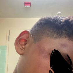 Cucamonga Middle School - He also had more bruising to the back of his head