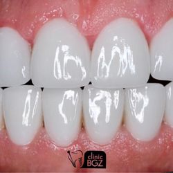 BGZ Dental Turkey