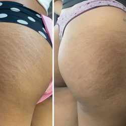 Bare Illusions